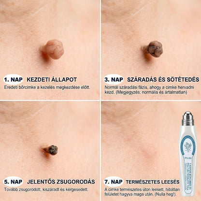 💎𝐏𝒊𝐜𝐝𝒐® 7 𝑵𝒂𝒑𝒐𝒔 𝑩ö𝒓𝒌𝒊𝒏ö𝒗é𝒔- É𝒔 𝑭𝒐𝒍𝒕𝒆𝒍𝒕á𝒗𝒐𝒍í𝒕ó(𝐹á𝑗𝑑𝑎𝑙𝑜𝑚 𝑛é𝑙𝑘ü𝑙, ℎ𝑒𝑔𝑒𝑘 𝑛é𝑙𝑘ü𝑙 – 𝑟𝑜𝑙𝑙𝑒𝑟𝑏𝑎𝑙𝑙)💪